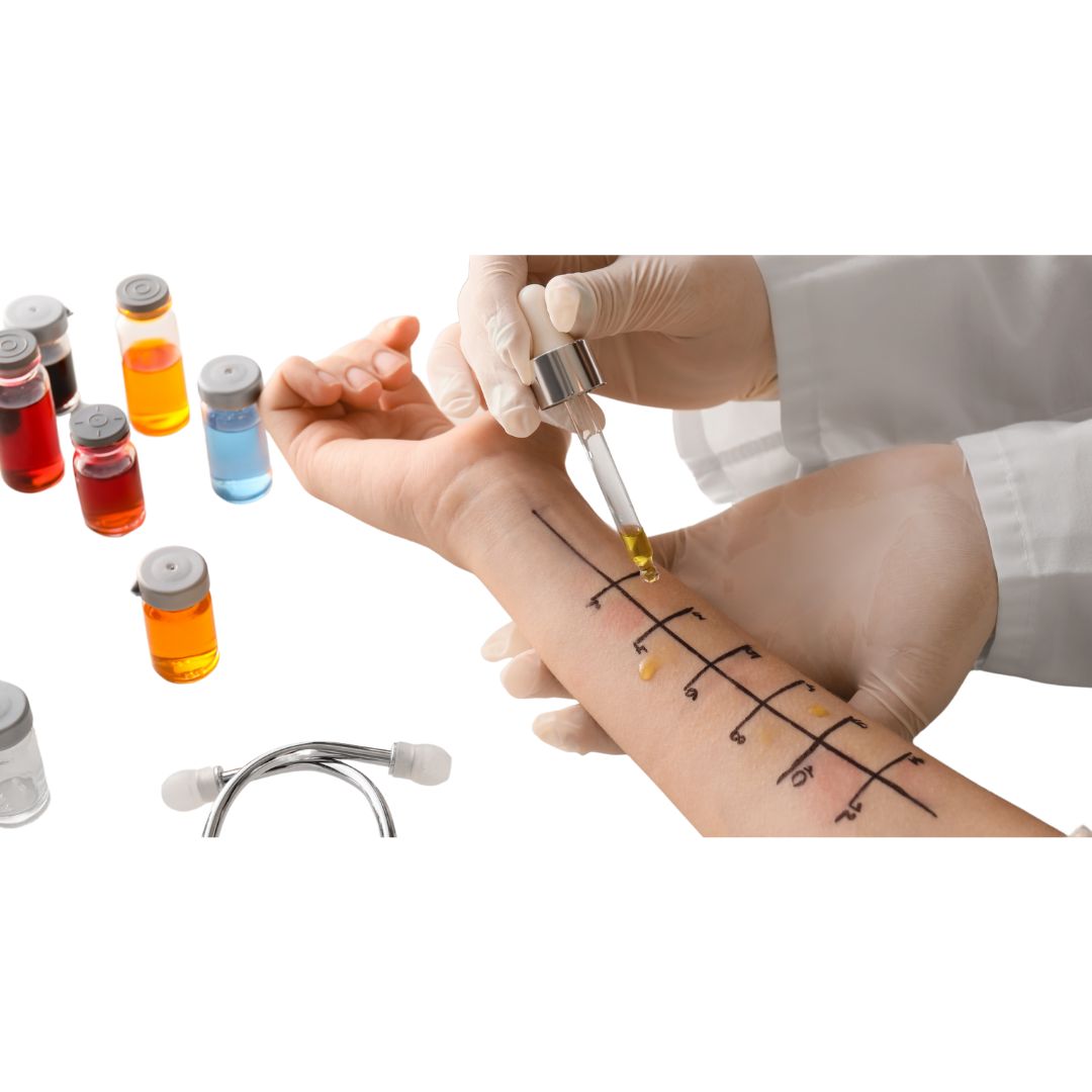 Allergy Testing